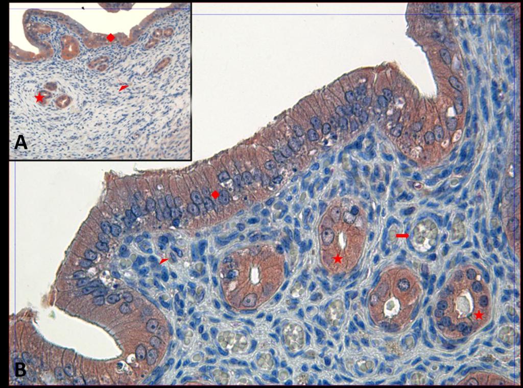 Fotoğraf 24A, B: Hipertermi uygulamasından bir saat önce NaCl+Katalaz uygulanan ve 24 saat sonra örneklerin alındığı gruba ait uterus dokusunda Kaspaz 3