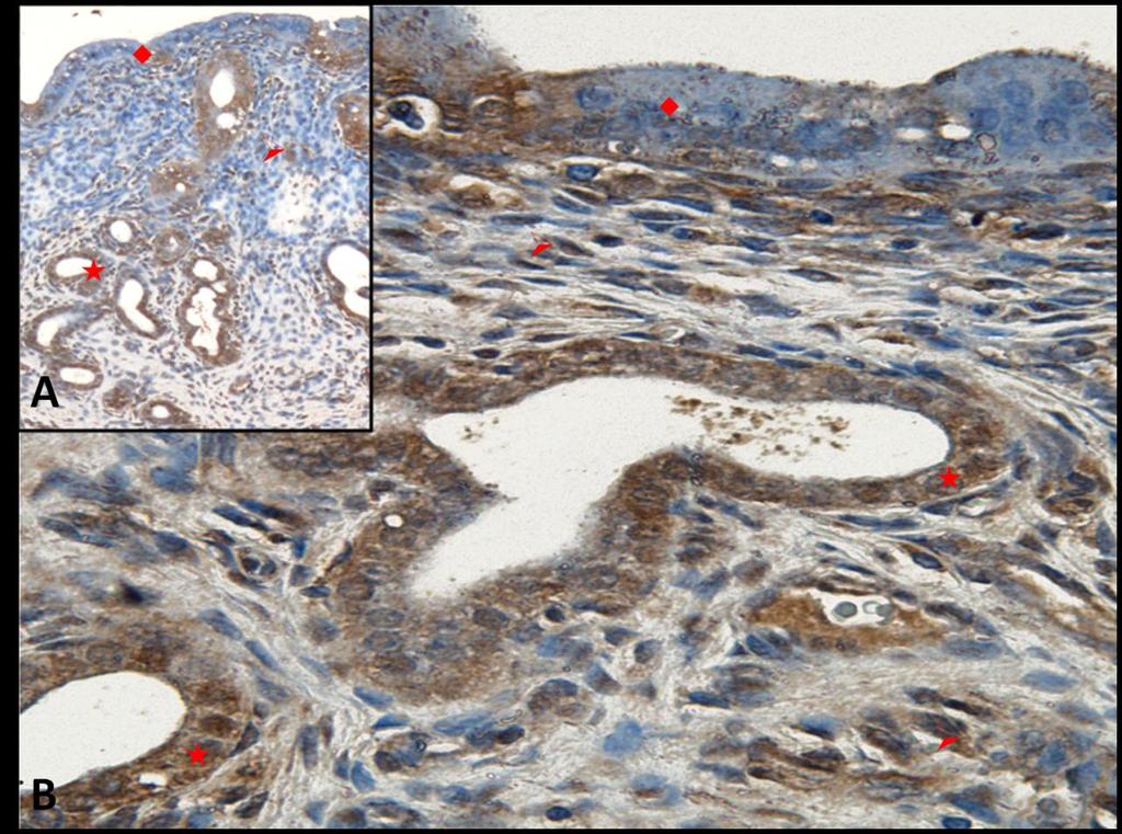 Fotoğraf 33A, B: Hipertermi uygulamasından bir saat önce NaCl+Katalaz uygulanan ve 24 saat sonra örneklerin alındığı gruba ait uterus dokusunda Hsp70