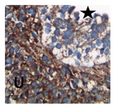 E18 TGF- β ekspresyonu (x40) E18 TGF- β reseptör ekspresyonu (x40) Postnatal 1.