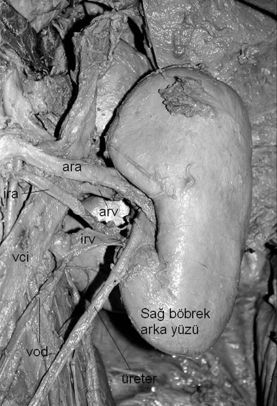 286 Resim 2: Sağ böbreğin arkadan görünümü. ara: ana renal arter; ira: ilave renal arter; arv: ana renal ven; irv: ilave renal ven; vci: vena cava inferior; vod: vena ovarica dextra Wozniak ve ark.