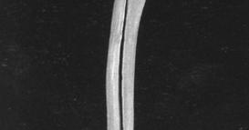 annulare radii ile de radius ve ulna arası bağlantı sağlanmış olur (Evans ve Christensen, 1980; Dursun, 1996).