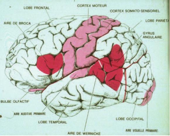 Dyspraxia s Primary Motor Cortex >> Dyspraxia s > Typology the underlying process