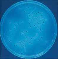 TSC Agar (Tryptose sulfite cycloserine agar) base for microbiology, dehidre (M111972) (TS 8020 EN 26461-2'ye göre alternatif besiyeri) 3.