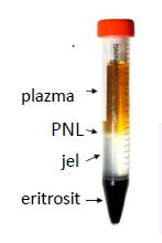 PKMNH izolasyonu ELISPOT ( Enzyme-Linked Immunospot