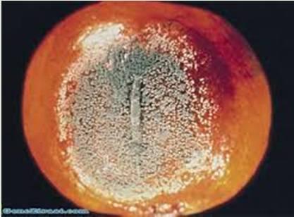 Sclerotinia Çürüklüğü (Monilia Çürüklüğü): Genelde sert