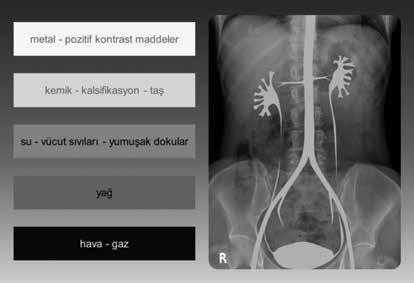 Pozitif kontrast madde olarak kullanılan baryum ve iyot gibi maddelerin atom numaraları ve yoğunlukları vücut oluşumlarından belirgin yüksektir.