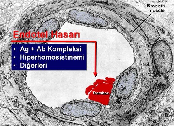 Otoimmün hastalıklar (Lupus E.