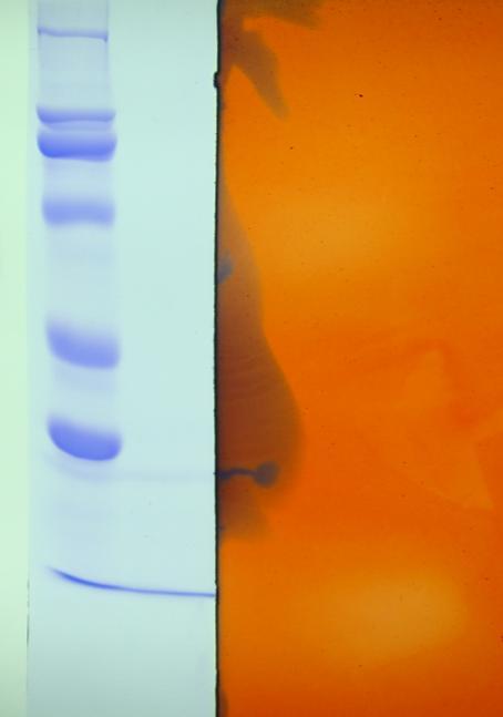 4.BULGULAR VE TARTIġMA Zeliha Nurdan SARAÇOĞLU 200 kda 116 kda 97 kda 66 kda 62.4 kda 45 kda 29 kda 22 kda ġekil 4.9. Bacillus sp.