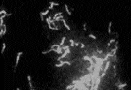 Helicobacter pylori İzolatlarının Antibiyotik Direnç Oranları ve Klaritromisine Dirençli Suşların Saptanmasında E-Test ve Floresan İn Situ Hibridizasyon Yöntemlerinin Karşılaştırılması ri varlığı