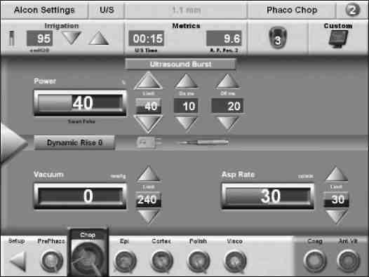 Şekil 2-61: Ultrason Patlamalı Ameliyat Ekranı Bu, pedal pozisyon 3 e basıldığında ve 20 ms den az güç aktardığında ekranın bir örneğini göstermektedir.