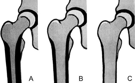 3. Manyetik Rezonans Görüntüleme: Avasküler nekroz, Labral lezyon, kitle vb. 4. Kemik sintigrafileri : Tümör, metastaz, enfeksiyon gibi durumlarda isteebilir.