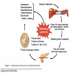 Akut Pankreatit REFEEDİNG SENDROM Hipertrigliserideminin (>12 mmol/l) oluşması durumunda infüzyon geçici olarak kesilmelidir C Multivitaminler ve eser elementlerin günlük dozu önerilmektedir C PN