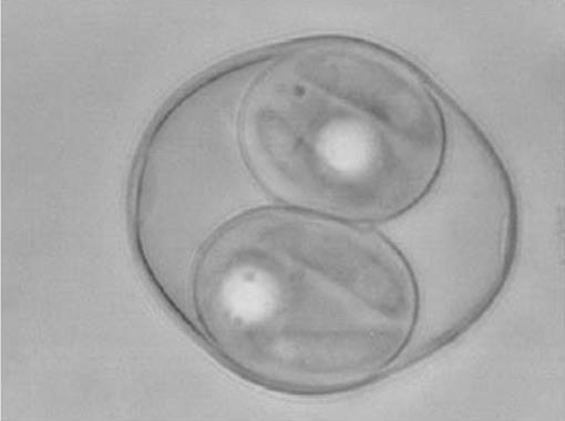 Toxoplasma gondii Protozooa Zorunlu hücre içi parazit Hızlı çoğala takizoit;