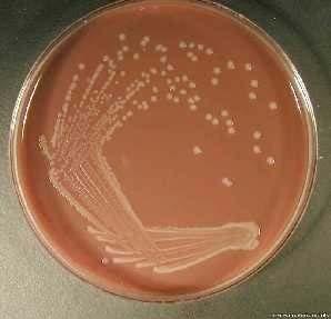 Kültür Etken tanımlama Bakteriyel menenjitler Altın