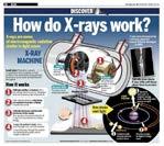 Dr.Mustafa ÖZATEŞ DÜZ (DİREKT) GRAFİLER RADYOGRAFİ SİSTEMLERİ: 1- Dijital X-ray Dijital radyografi sistemleri: Dedektörler aracılığıyla teşhis amaçlı görüntüler çeker.