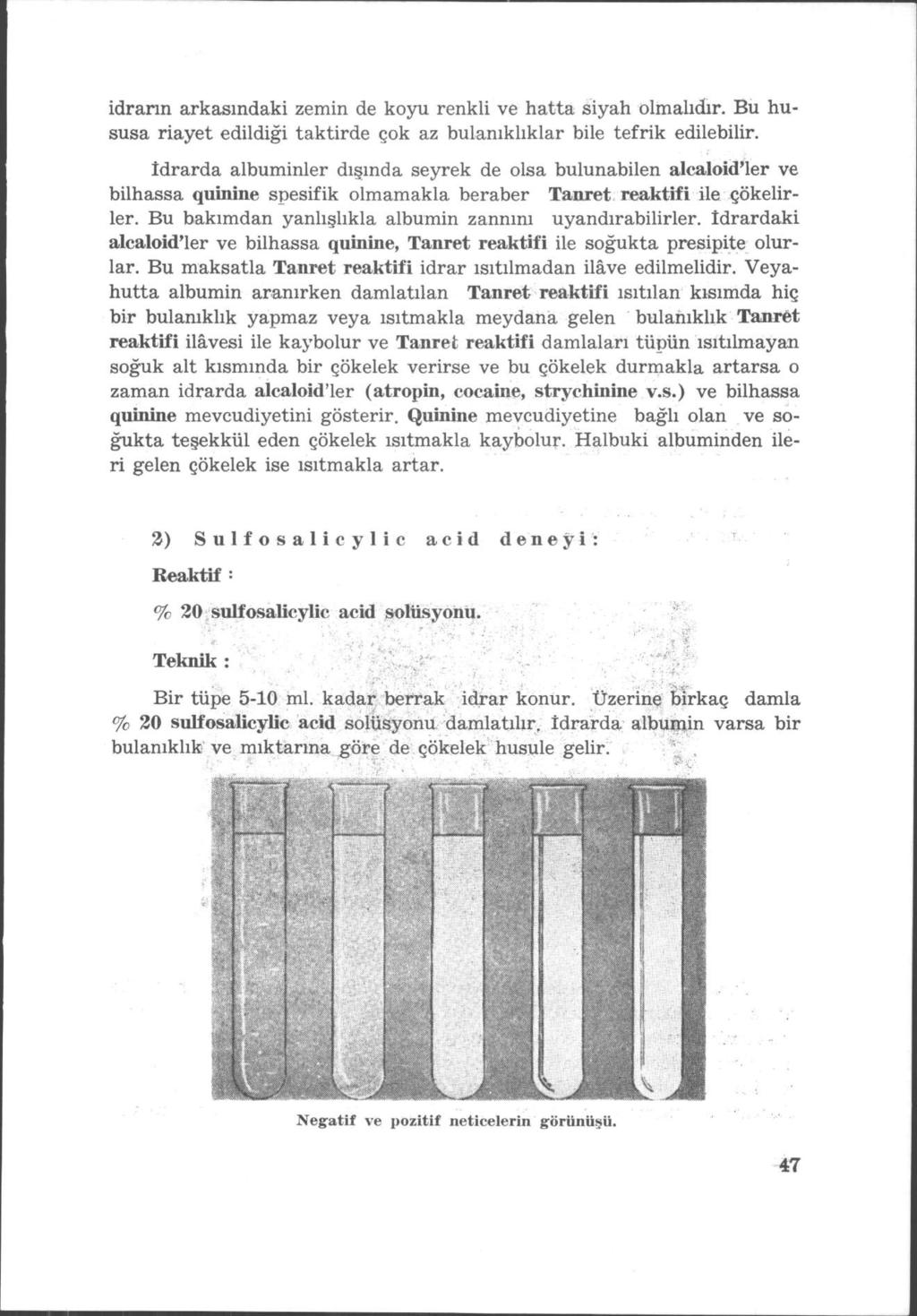 idrarın arkasındaki zemin de koyu renkli ve hatta siyah olmalıdır. Bu hususa riayet edildiği taktirde çok az bulanıklıklar bile tefrik edilebilir.