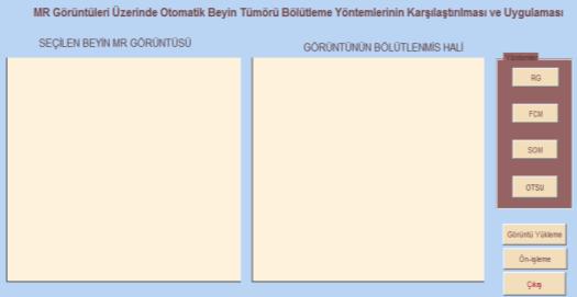 FCM ile gerçekleştirilen bölütleme işleminde tümör bölgesinin büyük oranda bölütlendiği, ancak bazı kalıntılar olduğu görülmektedir.