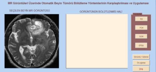 Tasarlanan uygulamanın arayüzü Uygulama çalıştırıldıktan sonra ilk aşama Şekil 3 üzerinde gösterildiği gibi görüntü veritabanından uygun bir beyin MR görüntüsünün seçilmesidir.