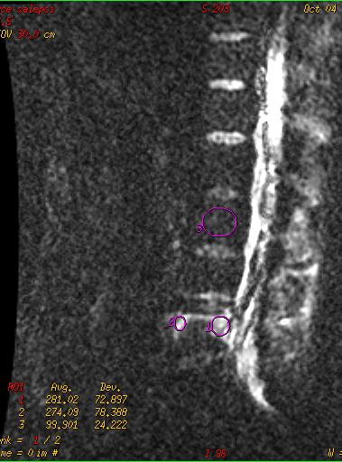 15 x 10-3 sec/mm2