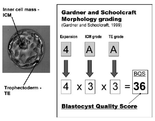 Blastosist Kalitesinin Değerlendirmesi (TVUSG) aracılığı ile ölçülerek değerlendirildi.