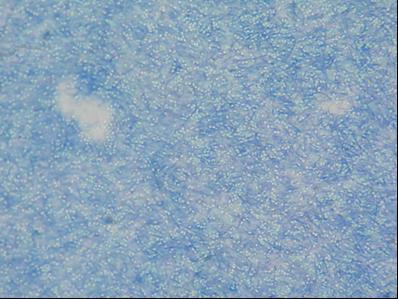 18 Şekil 4.4. 20 kat seyreltilmiş nisinin B. coagulans DSMZ-1 e karşı aktivitesi. (Aktivite >2560 AU/ml) 4.2. Endospor Boyama Sonuçları Metilen mavisi ile basit boyaması yapılan B.
