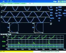 Inﬁnity Gateway Suite Server Yazılımı D-1195-2009 Inﬁnity Gateway, Inﬁnty Network ve mevcut IT altyapısı arasında sorunsuz bir entegrasyon sağlayan açık,