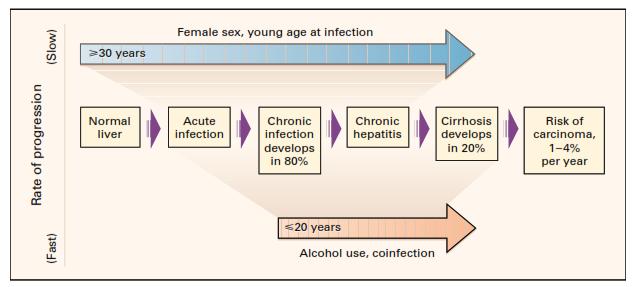 Hepatit C Erkek cinsiyet, geç yaşta