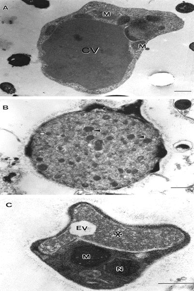 Şekil 2.1. Blastocystis spp. alttür 4 elektron mikrografi (A): İnce periferal sitoplazmik bantla çevrili büyük santral vakuol (CV) içeren vakuoler form.