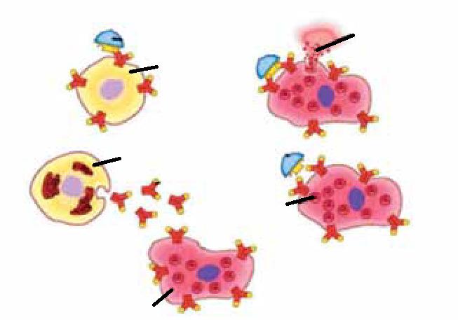 1 Alerjen Alerjik tepkime B hücresi Histamin ve diğer kimyasallar Alerjenle ilk temas 2 3 Mast hücresi Plazma hücresi Salınan IgE antikorları IgE algılayıcısı Alerjen 5 granül 4 Alerjenle sonraki