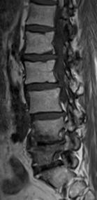 VERTEBRAL