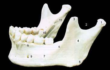 Mandibula 1. Mandibular Condyle 2. Mandibular Notch 3. Coronoid Process 4. Ramus 5. Angle 6.