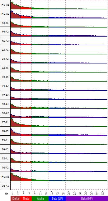 Amplitude spectrum graphs