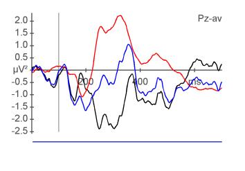 Temporal Gyrus Temporal Lobe  (significance) Brodmann