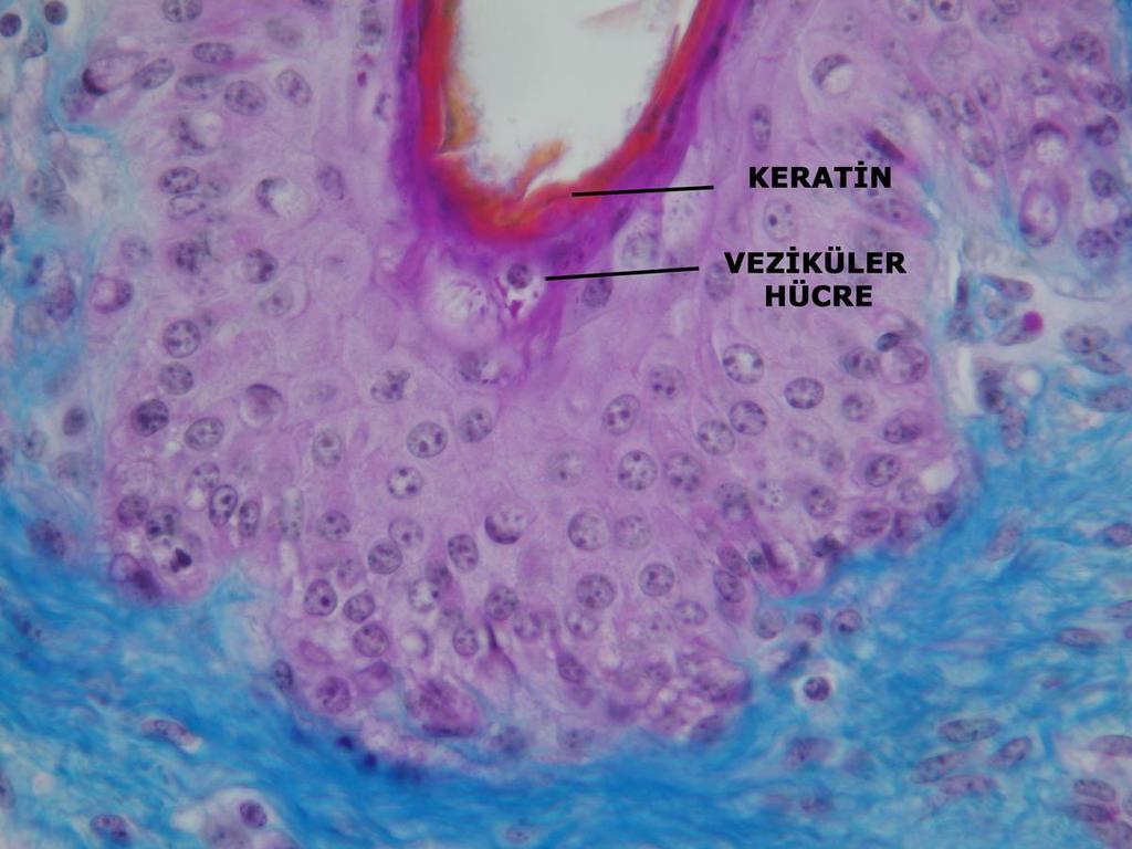 Boynuzlaşan bölümde normal durumda yassı olan hücreler (Tip A) yanında, zamanla