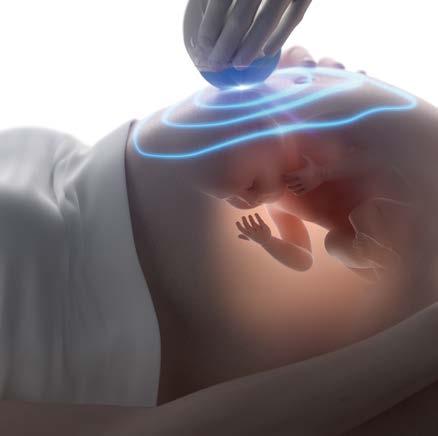 3 Bebeğimize konjenital hipotiroidi teşhisi kondu, bebeğimizde zeka geriliği olur mu?