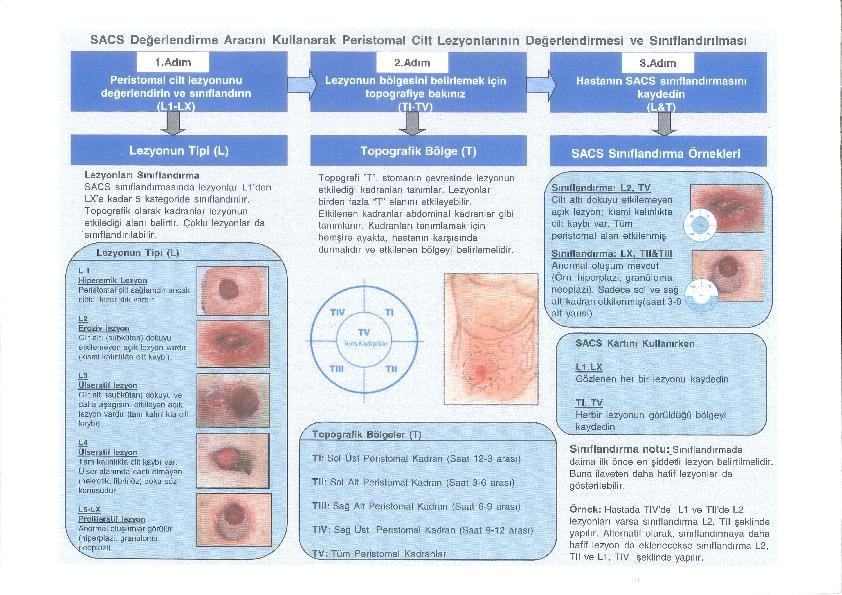 10. EKLER EK-1: SACS ARACI: PERİSTOMAL