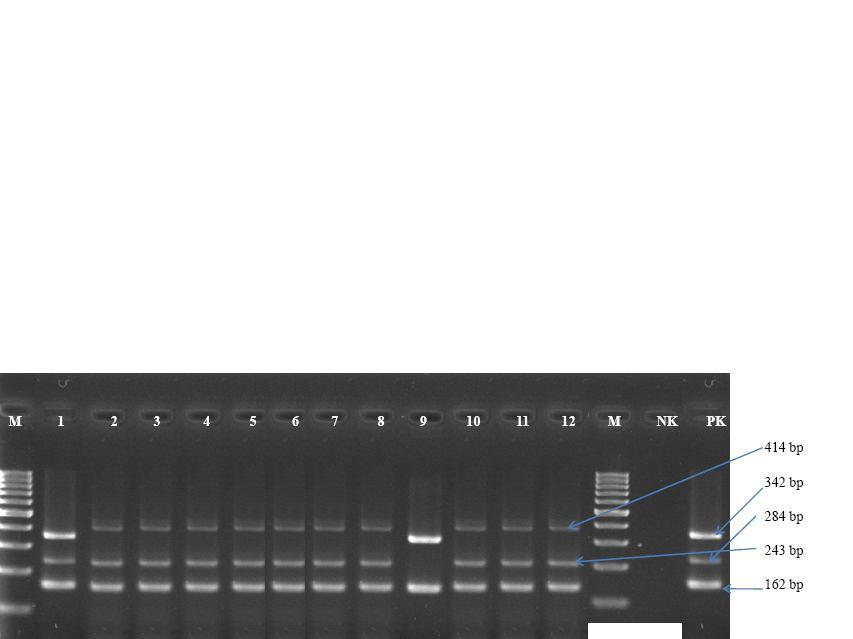 aureus suşları NK: negatif kontrol PK: pozitif kontrol M: 100 bp DNA ladder Resim 3.