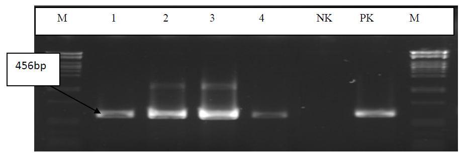 PstI enzimi ile kesilmiş lambda faj DNA sı Resim 3. 7.