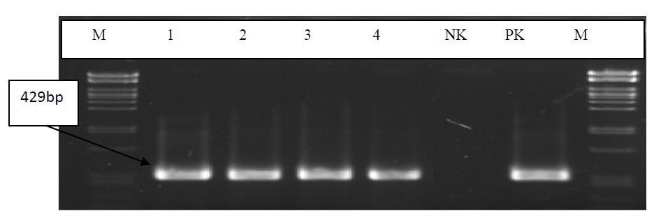 enzimi ile kesilmiş lambda faj DNA sı Resim 3.9. gmk genine ait elektroforez görüntüsü.