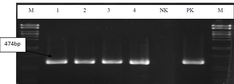 enzimi ile kesilmiş lambda faj DNA sı Resim 3. 10.