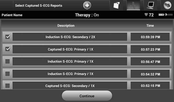 Captured S-ECG Report (Yakalanmış S-EKG Raporu) Bir Captured S-ECG (Yakalanmış S-EKG) raporunu yazdırmak için: 1.