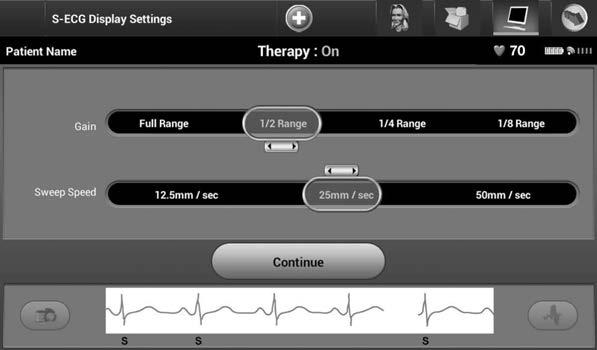 S-EKG Skalası Ayarları Gerçek zamanlı S-EKG genliğini ve görüntüleme hızı skalasını ayarlamak için: 1.