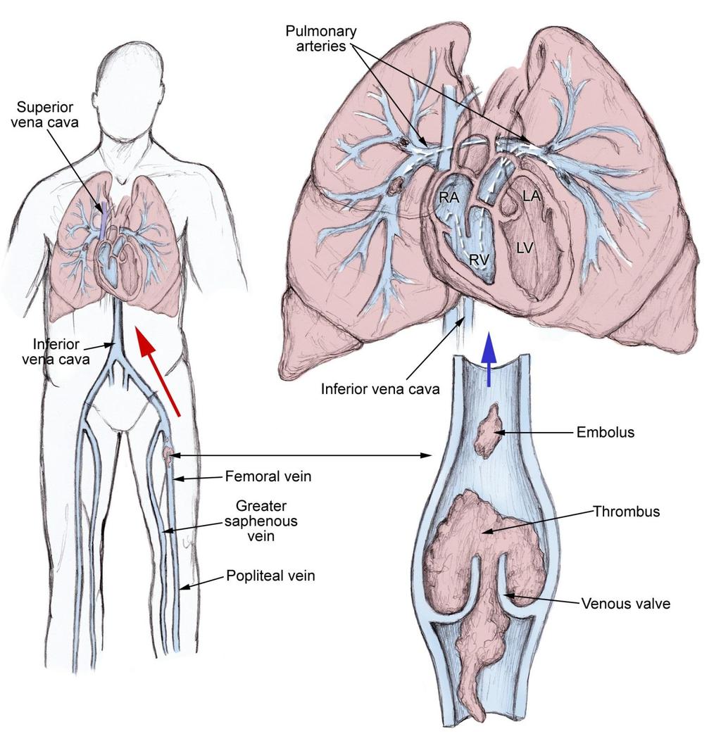 http://emedicine.medscape.