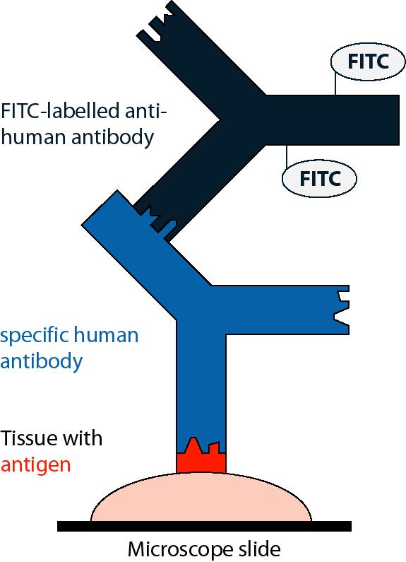 İndirekt İmmünofloresan Floresan mikroskopta değerlendirilir Floresan (FITC) işaretli anti