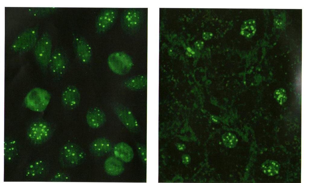 Nükleer dots (ANA) Hep-2