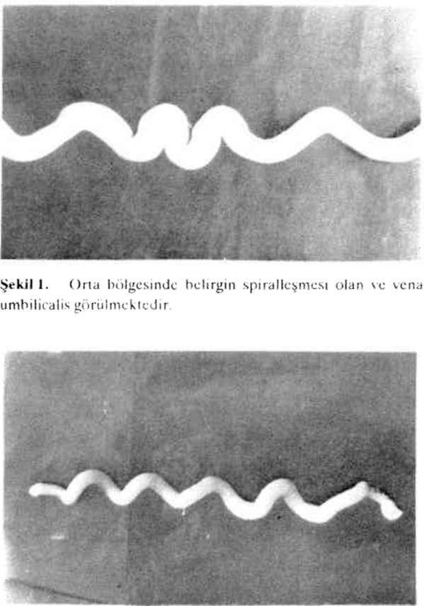 Cîöbck bağı ile ilgili yaptığımız bir çalışmada, göbek bağında damarların dışında kalan bölgenin nasıl beslendiği bizim için bir merak konusu oldu.