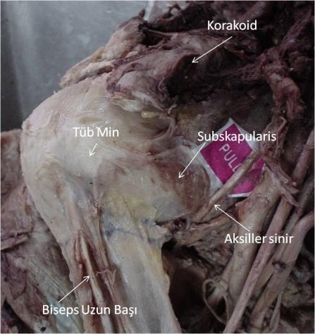 Şekil 4: Deltoid kası üç kısımdan oluşur (anterior, posterior ve orta). Bu bu kısımlar klavikula, akromion ve spinaskapuladan origo alarak humerus lateraline tüberositas deltoidea ya tutunur. ii.