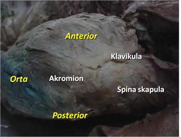 Humerus başının hemen altından geçerek posteriora yönelir ve kuadrangüler boşluktan çıkarak deltoid kası içerisine girerek kası inerve eder.