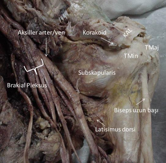 Rotator Manşet kasları; Subskapularis; Rotator manşetin önde olan tek kasıdır. Rotator manşet kasları arasında en büyük ve en güçlü olanıdır (şekil 8).