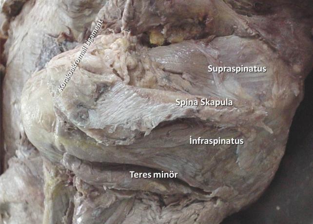 Şekil 9: Supraspinatus, supraspinatus fossadan başlayan ince bir kastır ancak yapışma yerine yakın kalınlaşır.
